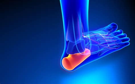 Plantar Fascitis Overview Symptoms Diagnosis And Treatments Ifar