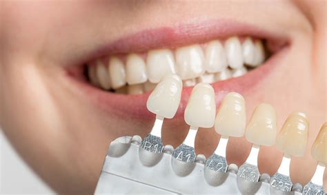 How To Rebuild Your Smile With Porcelain Veneers Smile Angels Of