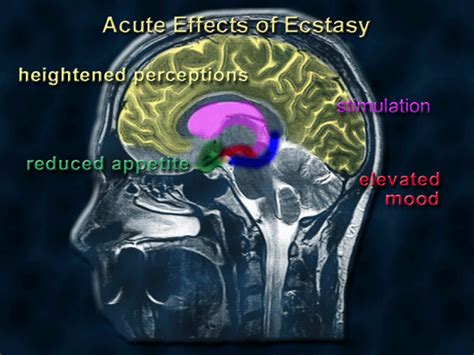 5: Short-term (acute) effects of ecstasy | National Institute on Drug ...