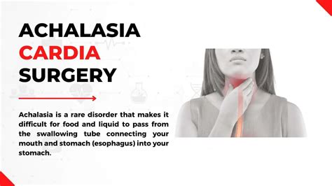 Best Achalasia Cardia Surgery Hospital In Tanda | #1 | Surgeon