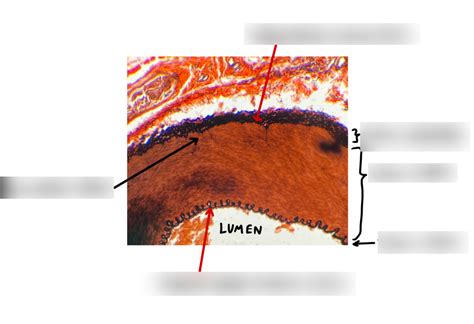 Diagram of Muscular artery photo | Quizlet