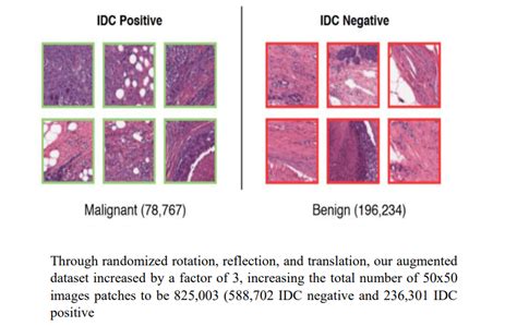 Breast Cancer Detection Using Deep Learningbreast Cancer Detection