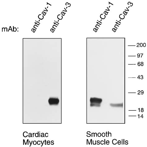 Expression of caveolin-3 in cardiac myocytes and smooth muscle cells ... 