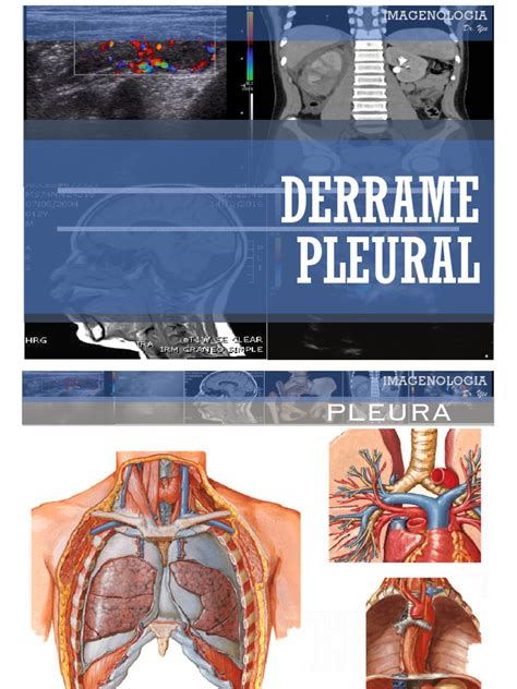 Patron Pleural Derrame Y Neumotorax Pdf Tórax Anatomía Humana