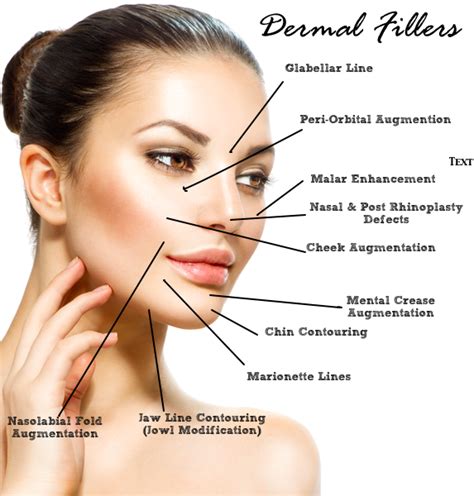 Botox And Dermal Fillers Juvederm Radiesse Restylane Voluma Belotero