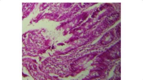 Desquamation of lining epithelium in intestine. | Download Scientific ...