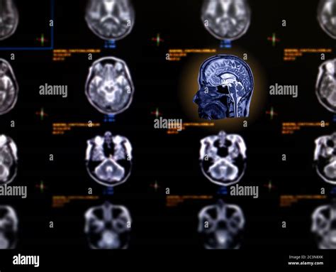 Sagittal View Immagini E Fotografie Stock Ad Alta Risoluzione Alamy