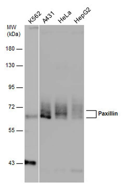 Paxillin Polyclonal Antibody (PA5-78143) 