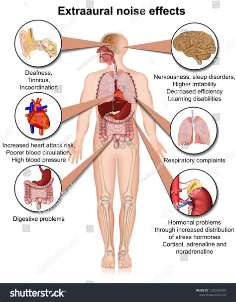 Extraaural Health Effects Chronic Noise Exposure Stock Vector (Royalty ...