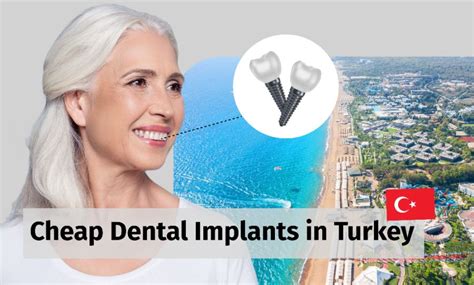 Cheap Dental Implants In Turkey Pros Costs And Reviews