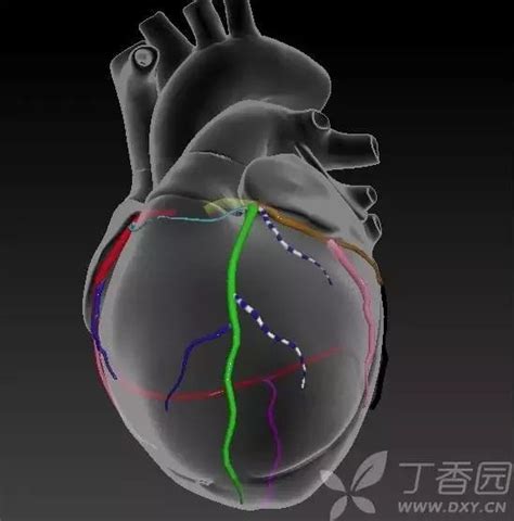 Pci专场丨一分钟读懂：心脏血管哪里堵了？心脏支架怎么放的？右冠