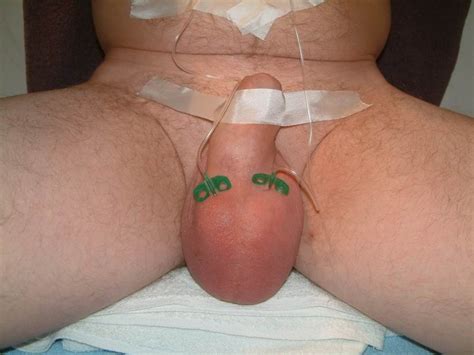 Extremely Pumped Cocks And Balls Porn Pictures XXX Photos Sex Images 3102865 PICTOA