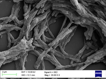 Mycobacterium smegmatis - Wikipedia