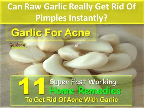 25 Natural Cystic Acne Treatments That Really Work Golden Home