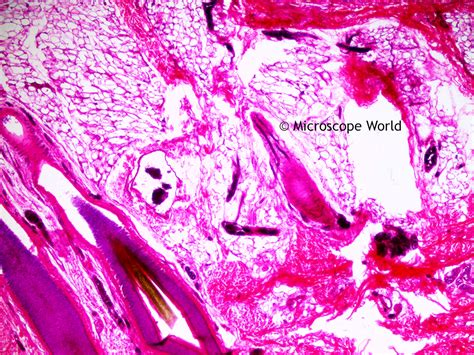 Microscope World Blog: Scalp with Hair under the Microscope