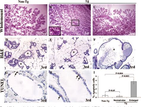 Figure 4 From Tumorigenesis And Neoplastic Progression Overexpression