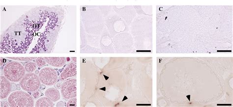 Figure 2 From Sex And Tissue Specific Expression Of P450 Aromatase