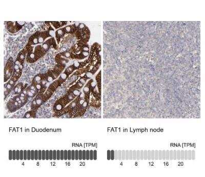 FAT1 Antibody NBP1 84566 Novus Biologicals