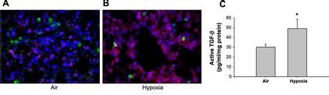 Figure 1 From Transforming Growth Factor Cid 1 Signaling Mediates