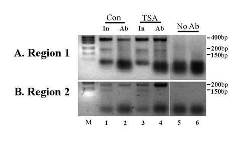 Chromatin Immunoprecipitation Assay Of Histone Acetylation At The H