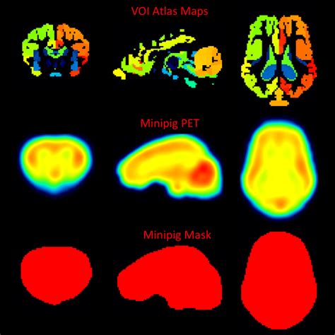 Volume Of Interest Voi Analysis Using Voi Atlas Files Voi Atlases