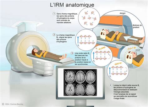 Quest ce quune IRM Examens médicaux Questions santé Une