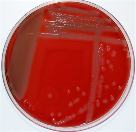 Staphylococcus Epidermidis Доксициклин Telegraph