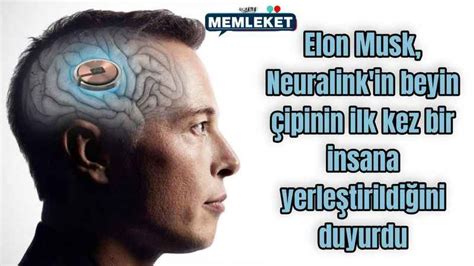 Elon Musk Neuralink In Beyin Ipinin Ilk Kez Bir Insana