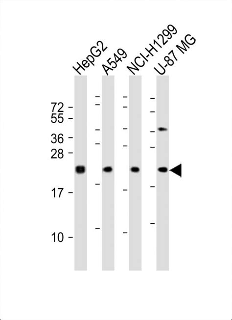 Rabbit Anti Ereg Polyclonal Antibody C Term Absin