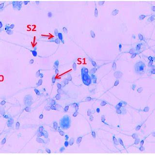 A Trypan Blue Staining Arrows Show The Penetration Of Stain Into The