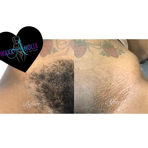 Brazilian Wax Before And After Pics