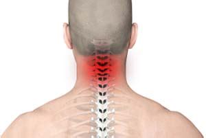 Neck Pain Advanced Orthopaedics Sports Medicine Orthopaedic