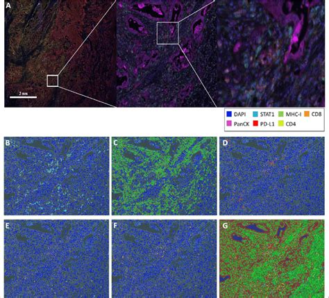 One Example Of Ihc Staining By The Perkinelmer Opal Multiplex System