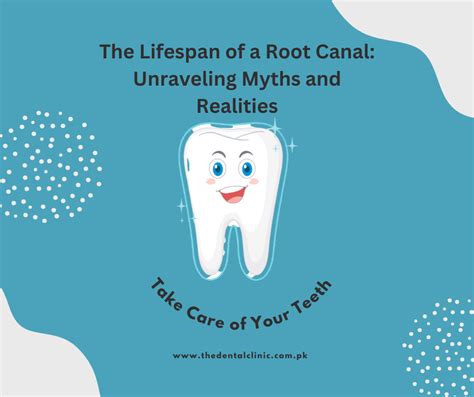 The Lifespan Of A Root Canal Unraveling Myths And Realities The