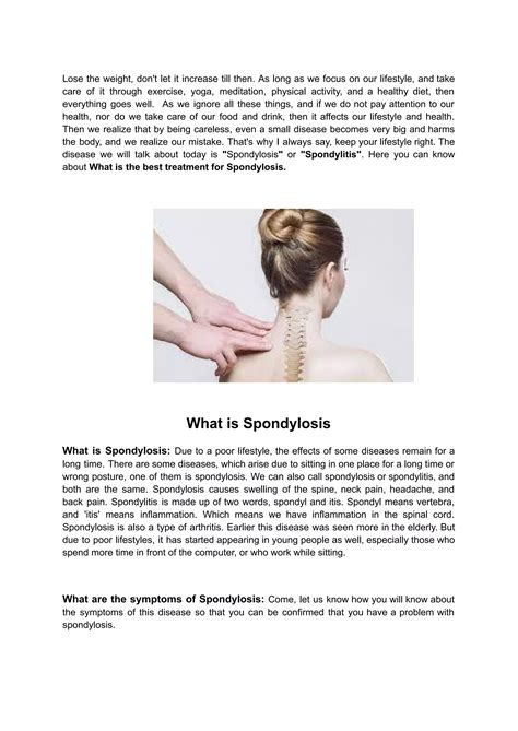 What is the best treatment for Spondylosis _.pdf | Physical Therapy