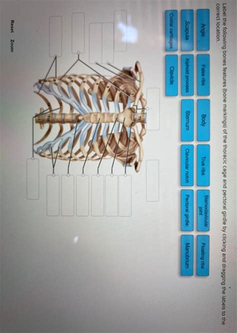 Solved Label The Following Bones Features Bone Markings Of