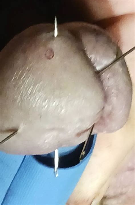 Needles In Cock Nude Pics XHamster