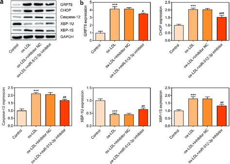 Downregulation Of Mir 512 3p Alleviated Ox Ldl Induced Er Stress In