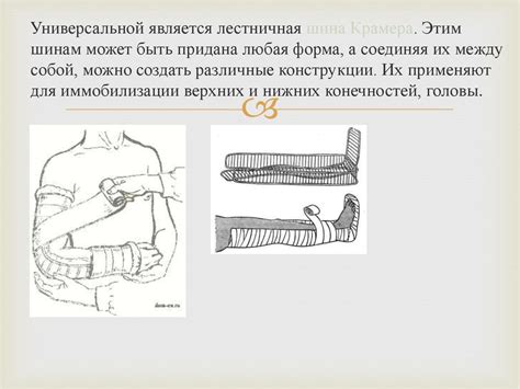 Иммобилизация - online presentation