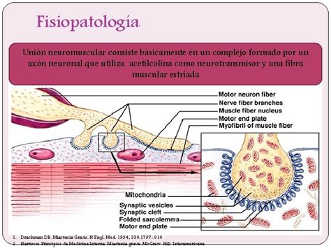 MIASTENIA GRAVIS ERIKA MARROQUIN FABIAN R 3 MEDICINA