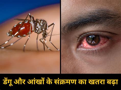 Dengue And Eye Infection Spreading Rapidly In Delhi After Yamuna Flood