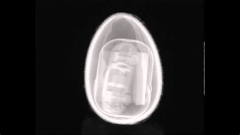 X Ray Ct Of A Kinder Egg Youtube