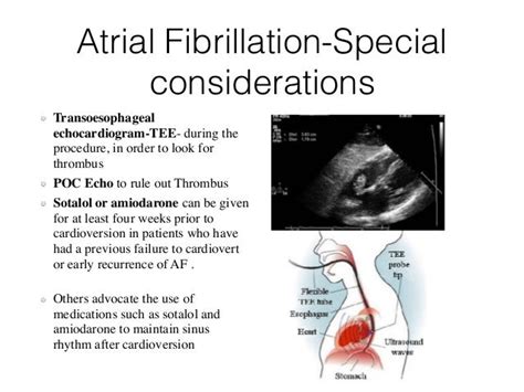 Defibrillation And Cardioversion