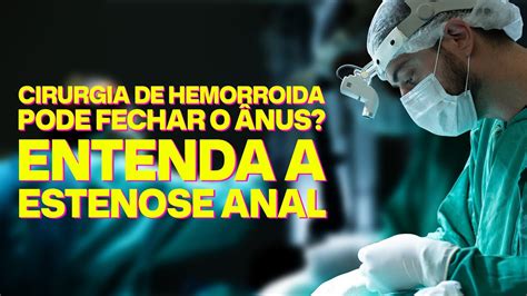 Complicações Graves da Cirurgia de Hemorroida O Que é Estenose Anal e