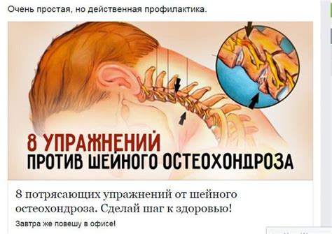 Шейный остеохондроз – весьма опасный недуг, который... | Интересный ...