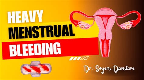 Heavy Menstrual Bleeding Causes And Treatment Heavyperiods