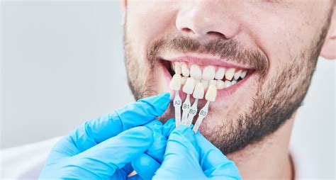 Dental Veneers Pros And Cons Advantages And Disadvantages