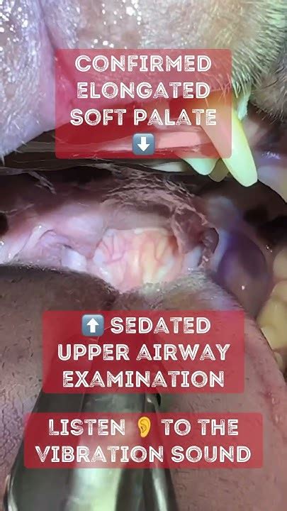 Frenchie Elongated Soft Palate And Laser Surgery Results Youtube