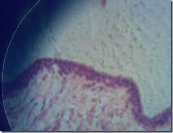 Histology Slides Database: Stratified columnar epithelium magnified