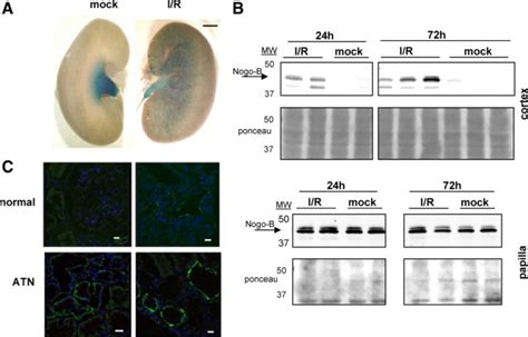 Identification And Regulation Of Reticulon B Nogo B In Renal Tubular